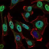NBN / Nibrin Antibody (aa400-650, clone 7E4A2)