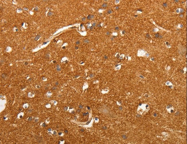 Polyclonal Rabbit anti-Human SLC4A4 / NBC1 Antibody (IHC)