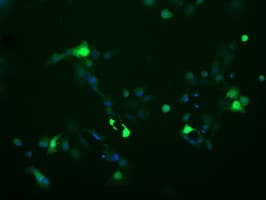 Monoclonal Mouse anti-Human CATIP / C2orf62 Antibody (clone OTI4A12, IF, WB)