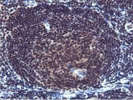 Cystatin SA / CST2 Antibody (clone OTI1D6)