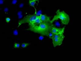 Monoclonal Mouse anti-Human L1CAM Antibody (clone OTI1A8, IF, WB)