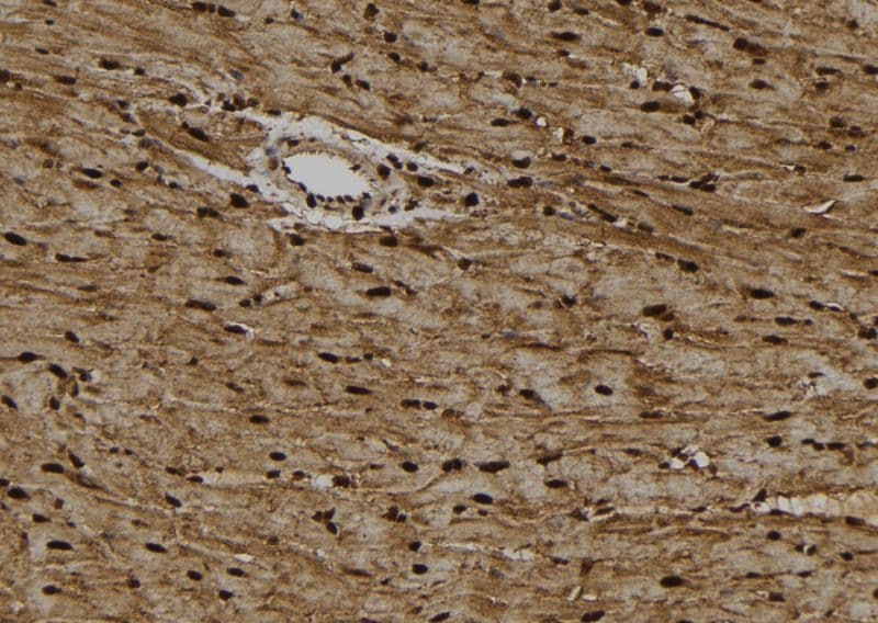 Polyclonal Rabbit anti-Human HSET / KIFC1 Antibody (IHC, IF, WB)