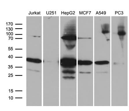 PPP4C Antibody (clone OTI2H8)