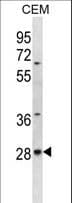 ALKBH4 Antibody (aa88-117)
