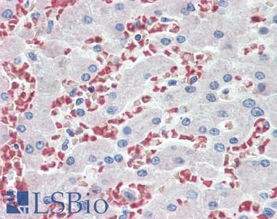 IHC-plus™ HBB / Hemoglobin Beta Antibody (aa1-147)
