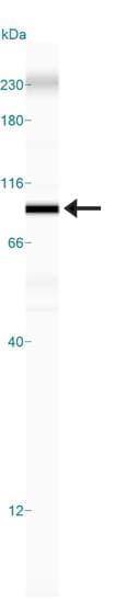 Polyclonal Rabbit anti-Human SIRT1 / Sirtuin 1 Antibody (aa400-450, WB)