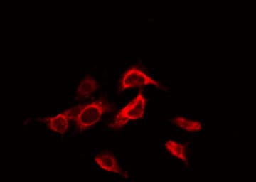 ADRB3 Antibody