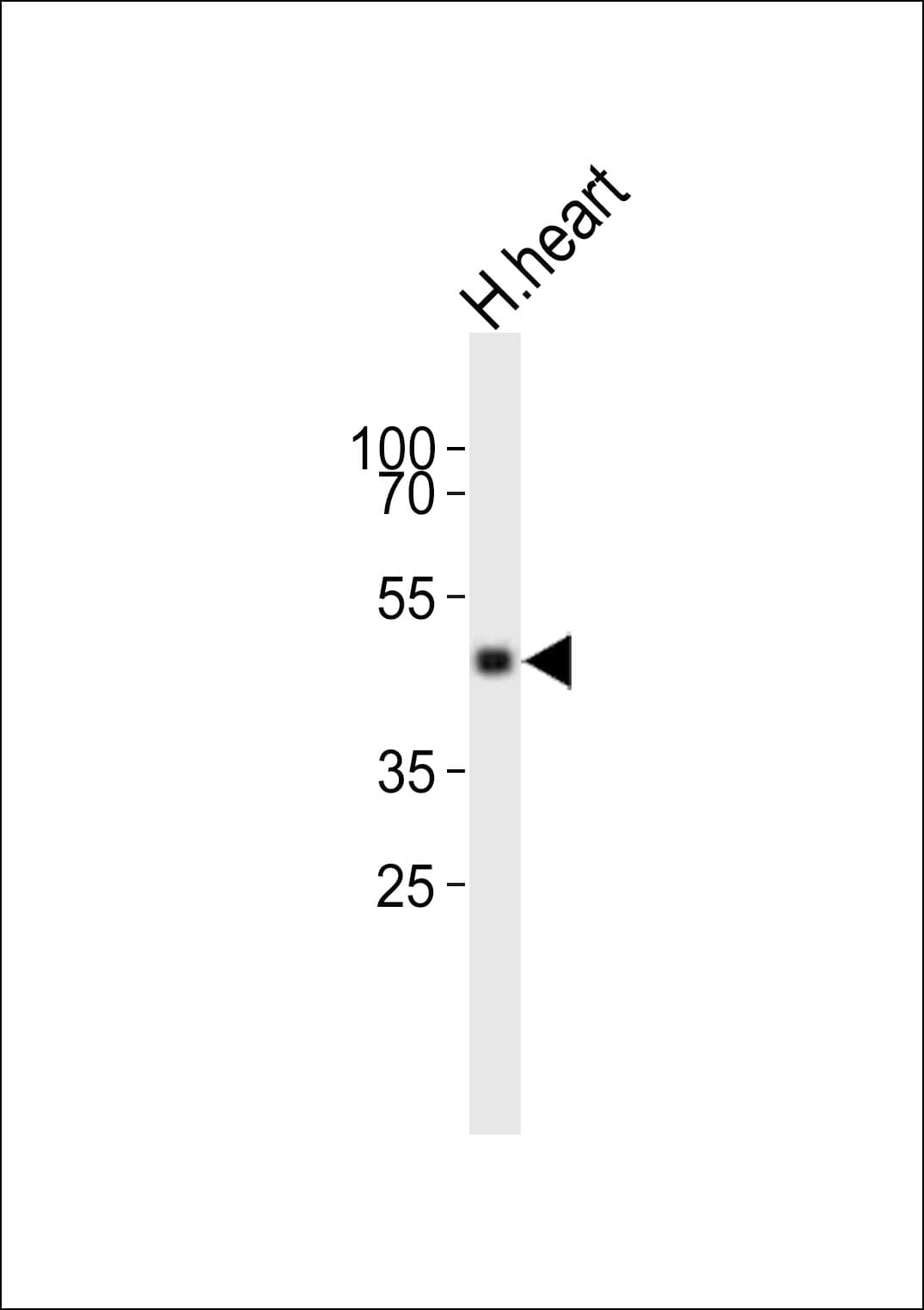 TIMM50 Antibody (aa25-56)