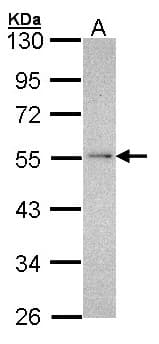 IHC-plus™ NDUFV1 Antibody (aa218-459)