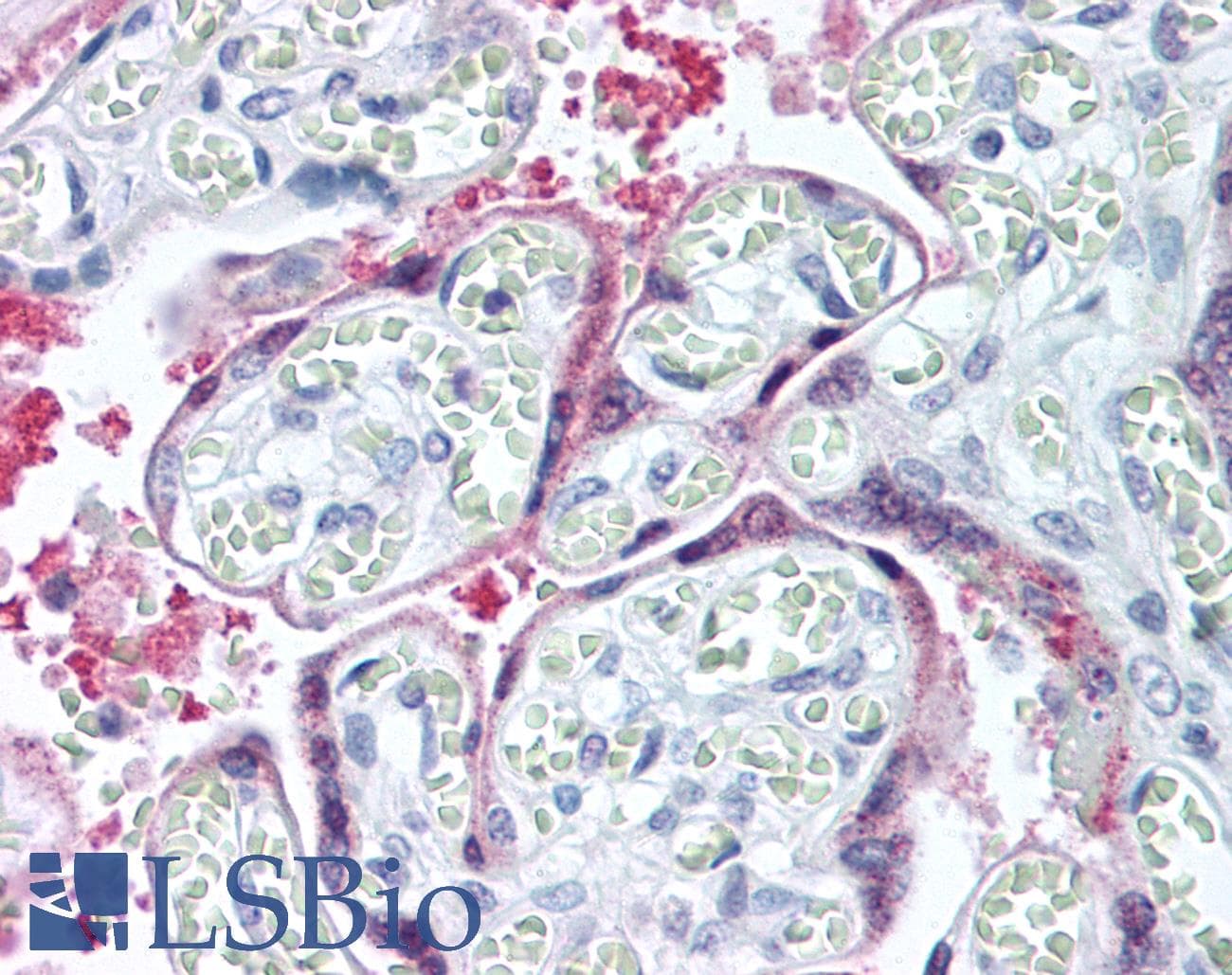 IHC-plus™ COL15A1 / Collagen XV Alpha 1 Antibody (C-Terminus)