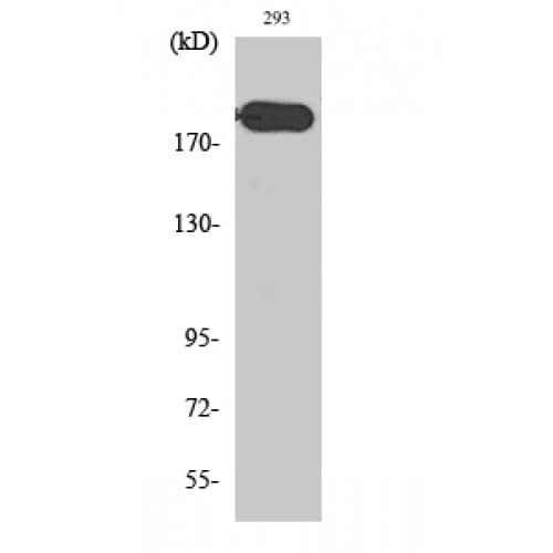 ABCA6 Antibody (1180-1260 aa, C-terminal)