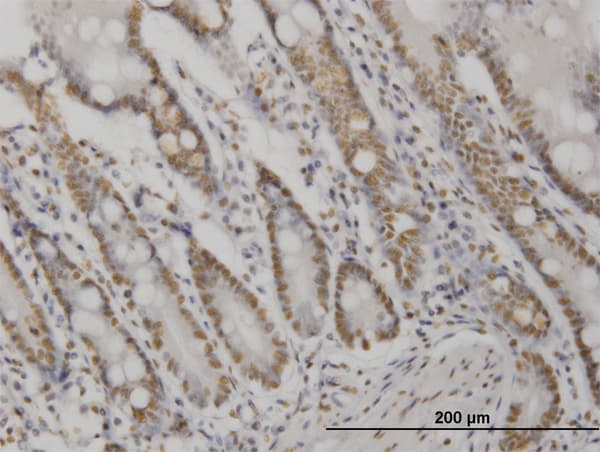 AKT2 Antibody (clone X1)