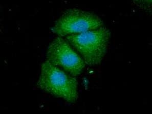 Monoclonal Mouse anti-Human ACSF2 Antibody (clone AT18B4, WB)
