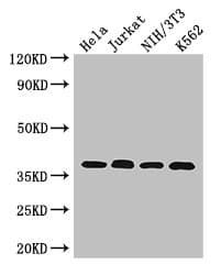RAD51 / RECA Antibody