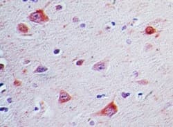 Polyclonal Rabbit anti-Human SOCS3 Antibody (aa170-220, IHC)