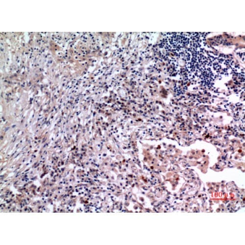 IL6 / Interleukin 6 Antibody (Internal)