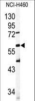 Polyclonal Rabbit anti-Human SIGLEC6 Antibody (aa10-40, WB)
