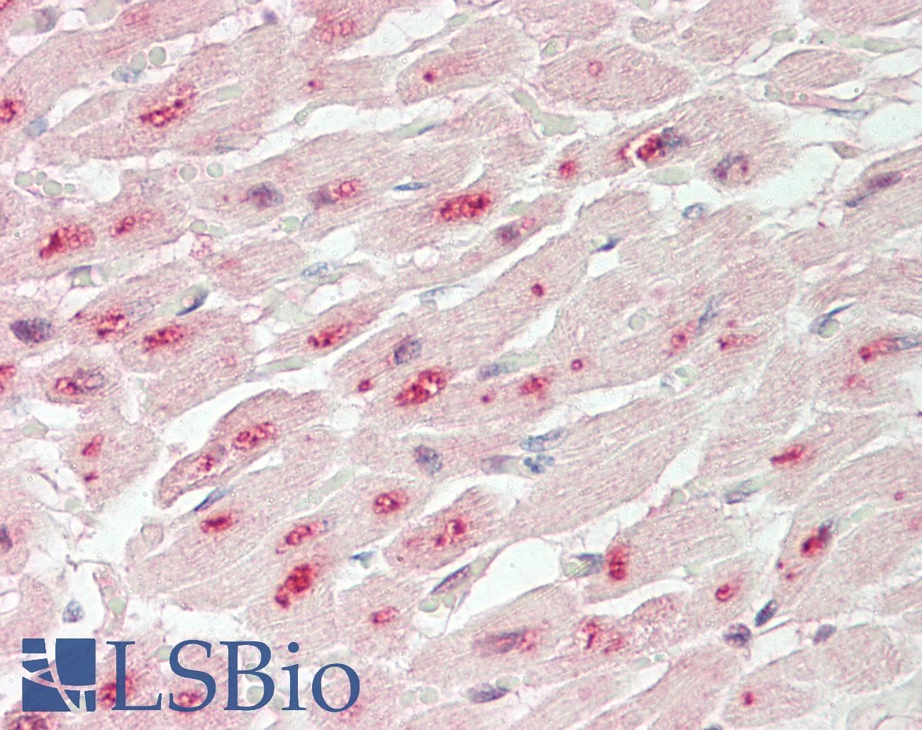 PPP1R13L / iASPP Antibody (aa756-805)