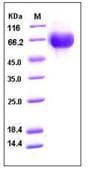 Human IL6R / IL6 Receptor Protein (Recombinant His,C-terminus)