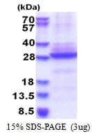 Human CHRNA6 Protein (Recombinant His)