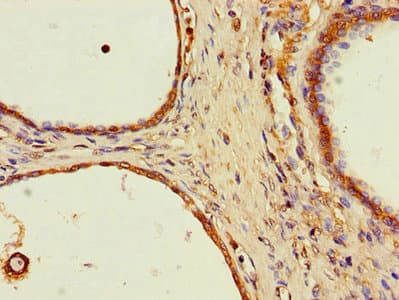 SPPL2A / IMP3 Antibody