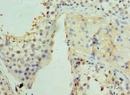 Polyclonal Rabbit anti-Human UCP1 / UCP-1 Antibody (aa1-307, IHC, WB)