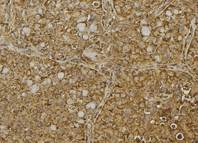 Dermatopontin / DPT Antibody