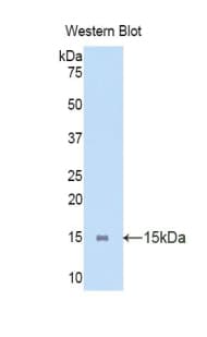LOXL2 Antibody (aa53-160)