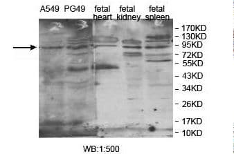 DDX20 / GEMIN3 Antibody (aa556-793)