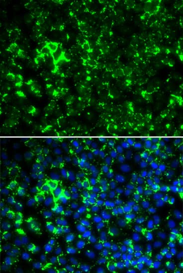 PathPlus™ Polyclonal Rabbit anti-Human KCNA2 / Kv1.2 Antibody (IHC, IF, WB)