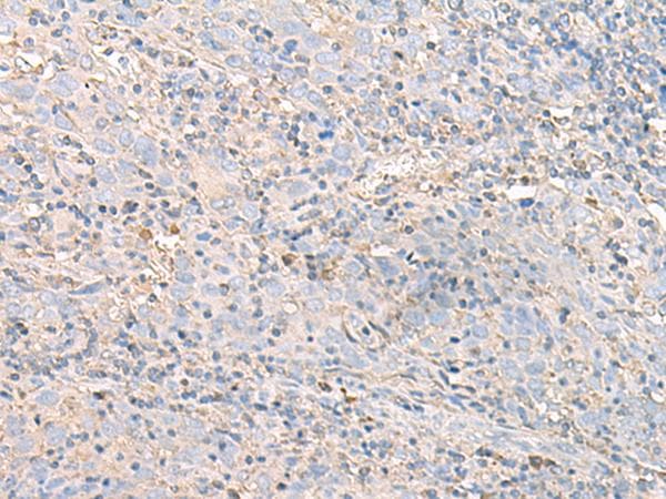IGHA1 / IgA1 Antibody