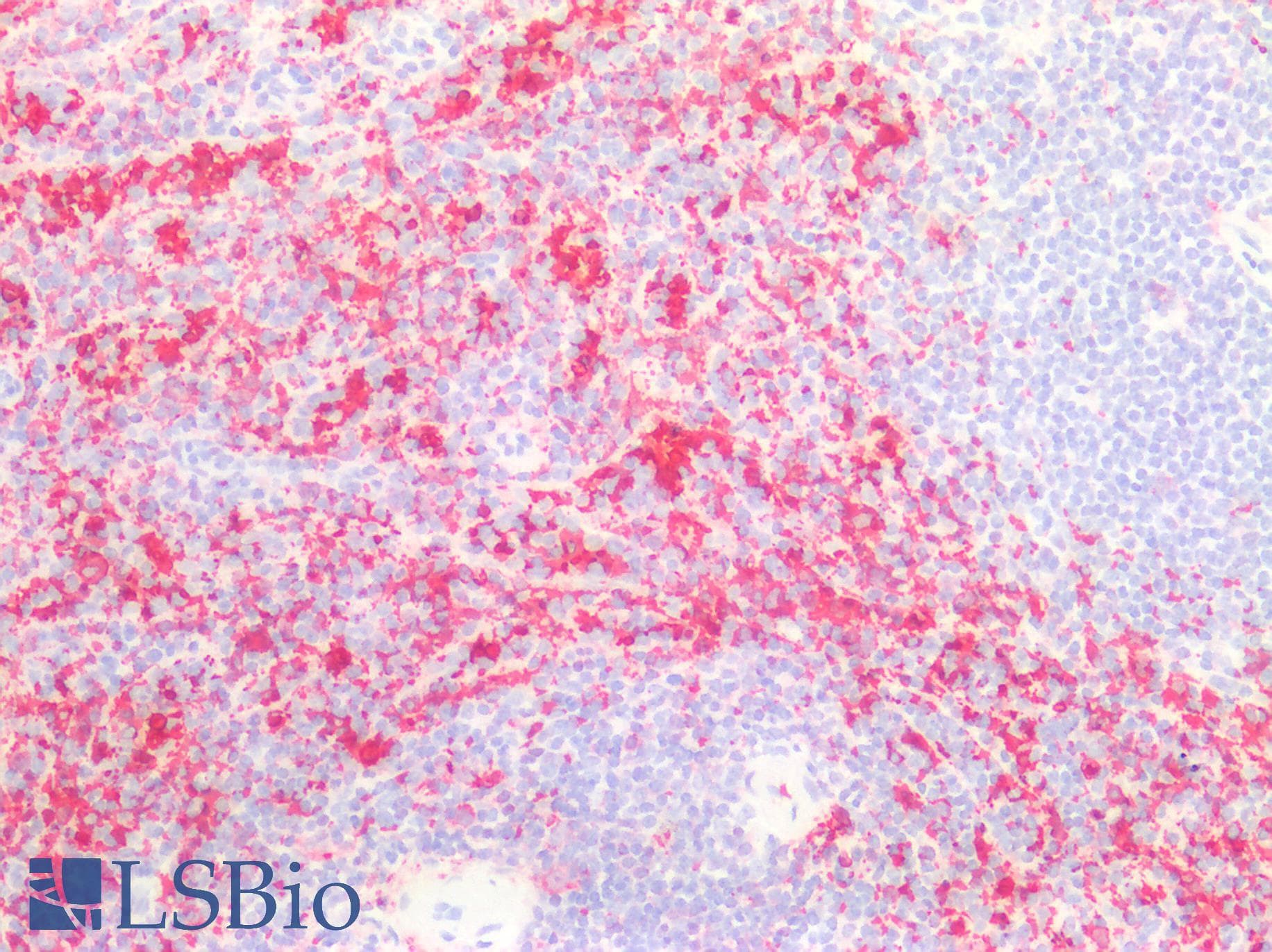 FTL / Ferritin Light Chain Antibody (aa5-183)