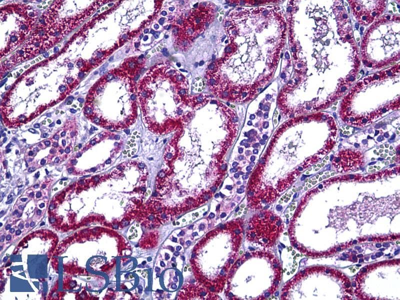 IHC-plus™ Polyclonal Rabbit anti-Human RBP5 Antibody (aa10-59, IHC, IF)