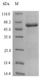 Escherichia coli lacI Protein (Recombinant 6His-SUMO, N-terminus)