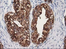 TUBB4 / Tubulin Beta 4 Antibody (clone 3C12, Carrier-free)