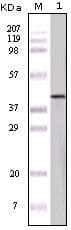 Ovalbumin Antibody (clone 3G2E1D9, 3D5F4A8, 3G1E1D9)