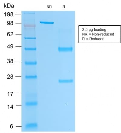 PathPlus™ ACPP / PAP Antibody (clone rACPP/1338)