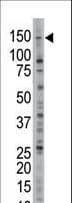 USP28 Antibody (aa111-141)