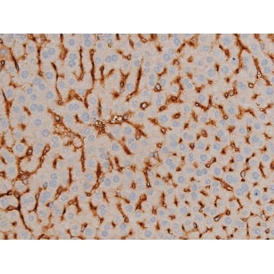Polyclonal Rabbit anti-Human BCL2 / Bcl-2 Antibody (phospho-Ser70, IHC, IF, WB)