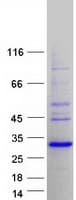 Human SSX2B Protein (Recombinant Myc-DDK (Flag))