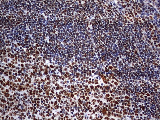 Monoclonal Mouse anti-Human HNRPM / HNRNPM Antibody (clone OTI1F6, aa1-261, IHC, WB)