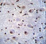 Polyclonal Rabbit anti-Human PAX6 Antibody (IHC, IF, WB)