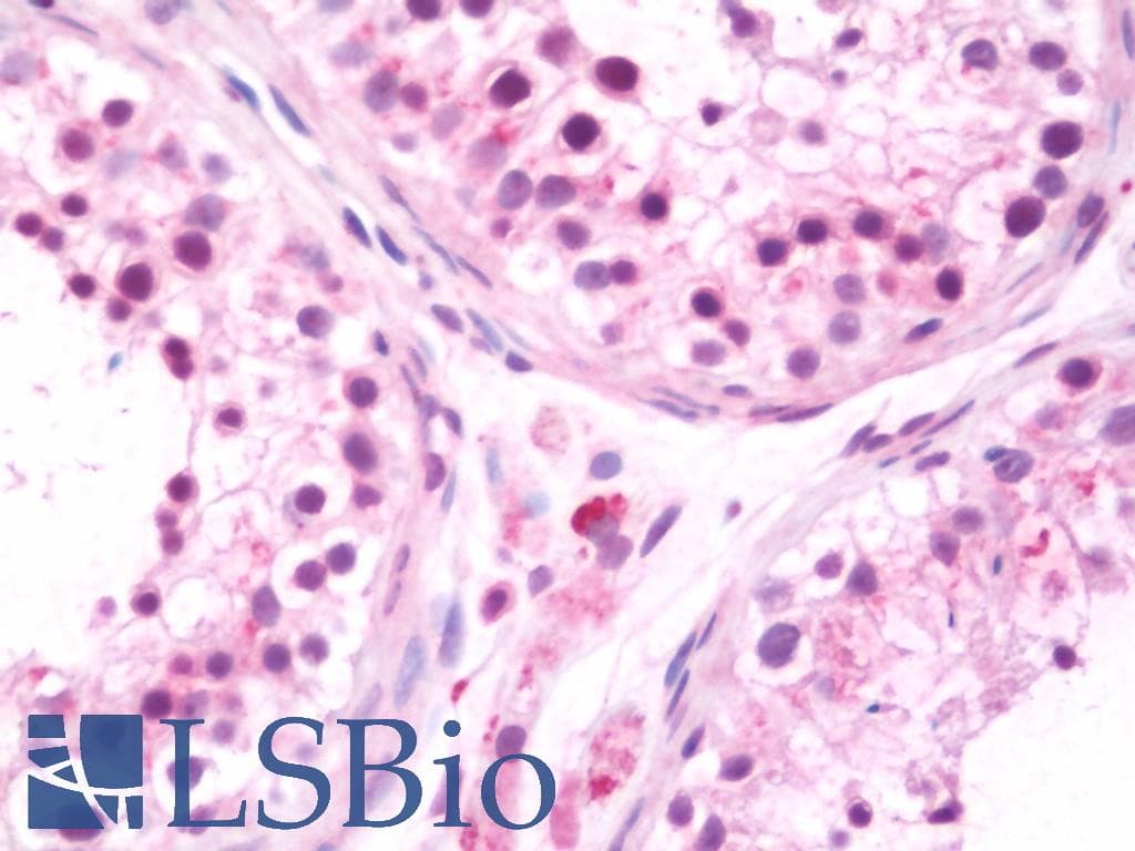 IHC-plus™ TBX1 Antibody (aa327-356)