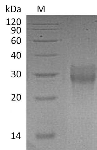 Human TNFRSF9 / 4-1BB / CD137 Protein (Recombinant 6His, C-terminus)