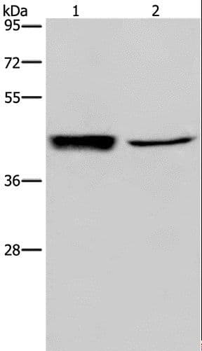 Polyclonal Rabbit anti-Human GRPR Antibody (aa322-365, IHC, WB)