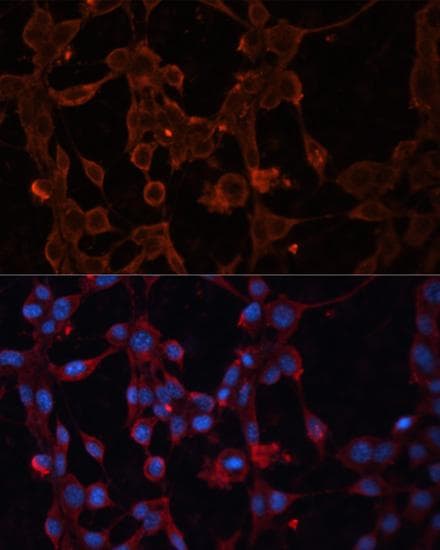 SLC25A27 / UCP4 Antibody