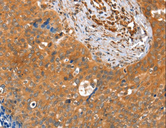 ACOT11 / THEA Antibody