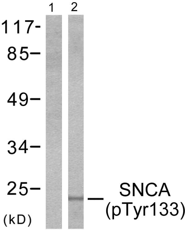 SNCA / Alpha-Synuclein Antibody (phospho-Tyr133)