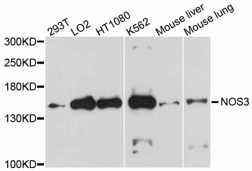 Polyclonal Rabbit anti-Human NOS3 / eNOS Antibody (IHC, WB)