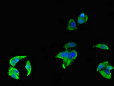 Polyclonal Rabbit anti-Human FCGR3A / CD16A Antibody (IHC, IF)